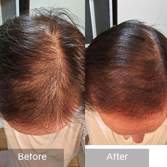 育毛・頭皮ケア
